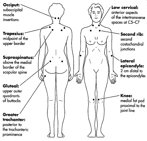 Solved Mystery of Fibromyalgia