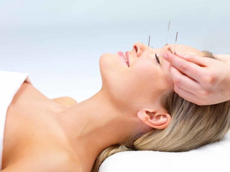 Cosmetic Acupuncture in Sherwood Park, AB